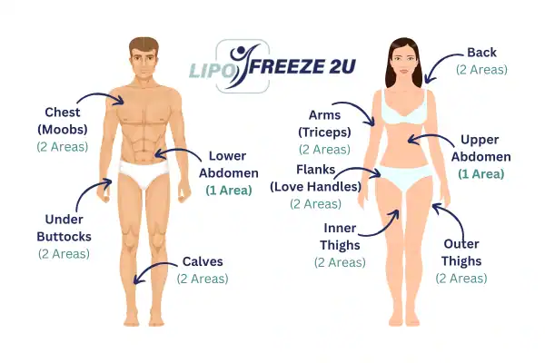 Areas you can have fat freezing treatment Tewkesbury