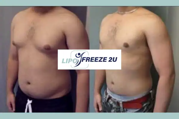 How Long Does It Take to See Results Tewkesbury?