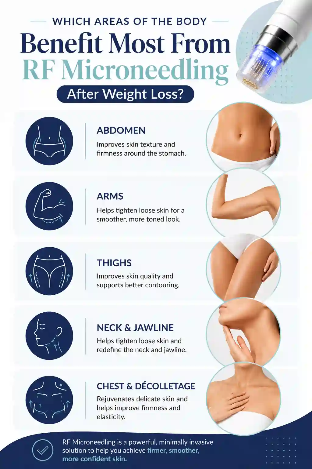 Which Areas of the Body Benefit Most From RF Microneedling After Weight Loss Tewkesbury
